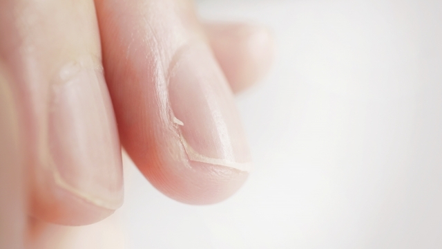 「ささくれは親不孝の証」その迷信の正体は、親の愛だった？