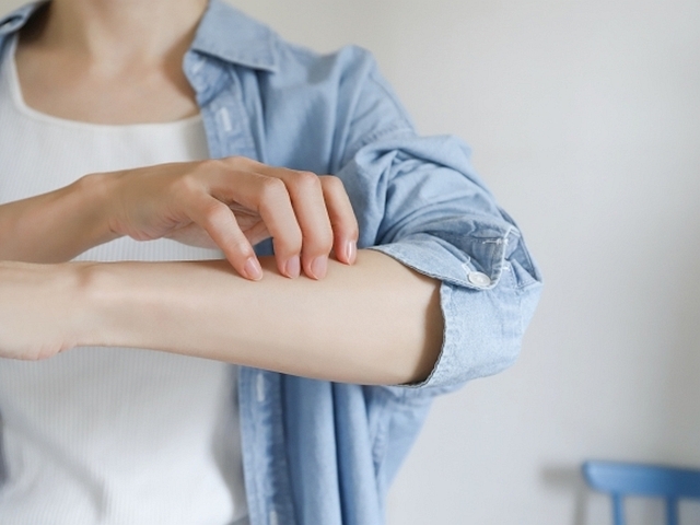 全身が痒くてたまらない！乾燥肌のケアはどうする？